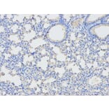 Immunohistochemistry - DPYD Antibody from Signalway Antibody (32346) - Antibodies.com