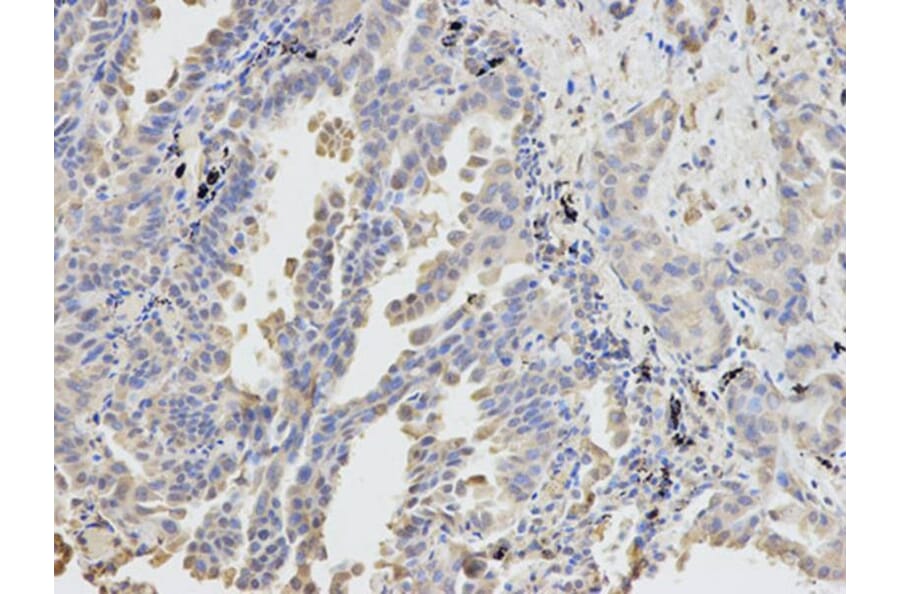 Immunohistochemistry - DPYD Antibody from Signalway Antibody (32346) - Antibodies.com