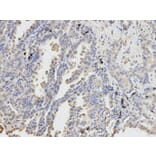 Immunohistochemistry - DPYD Antibody from Signalway Antibody (32346) - Antibodies.com