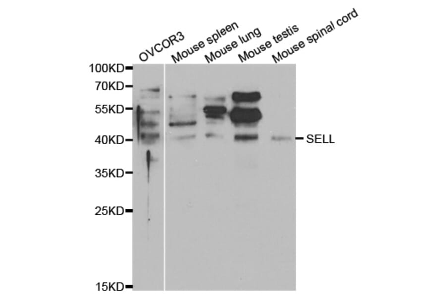 Western blot - SELL Antibody from Signalway Antibody (32348) - Antibodies.com
