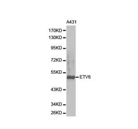 Western blot - ETV6 Antibody from Signalway Antibody (32358) - Antibodies.com