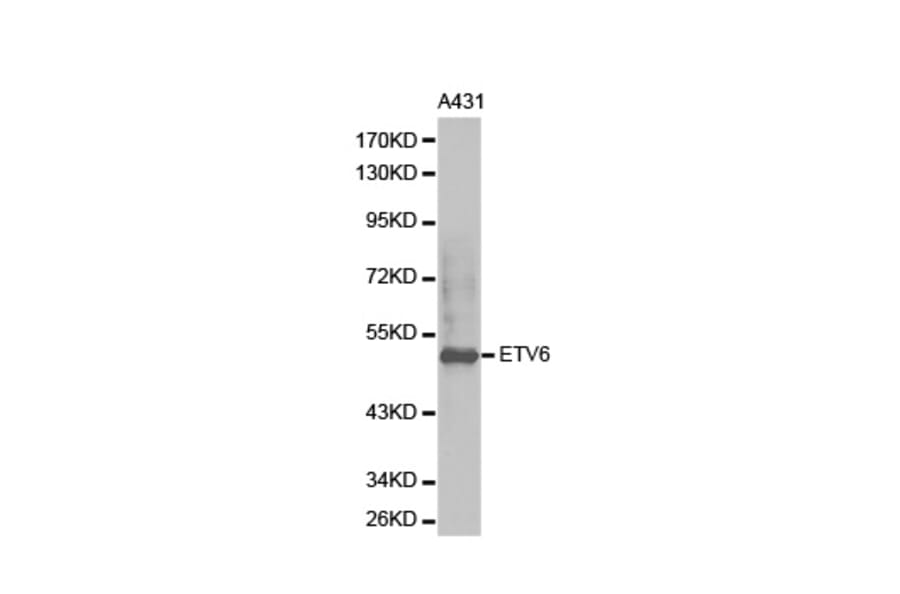 Western blot - ETV6 Antibody from Signalway Antibody (32358) - Antibodies.com