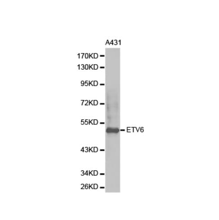 Western blot - ETV6 Antibody from Signalway Antibody (32358) - Antibodies.com