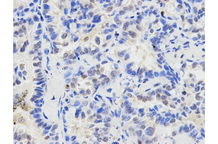 Immunohistochemistry - ETV6 Antibody from Signalway Antibody (32358) - Antibodies.com