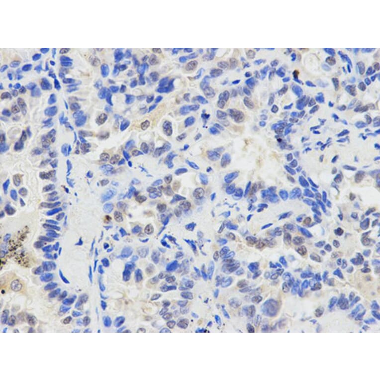 Immunohistochemistry - ETV6 Antibody from Signalway Antibody (32358) - Antibodies.com