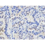 Immunohistochemistry - ETV6 Antibody from Signalway Antibody (32358) - Antibodies.com