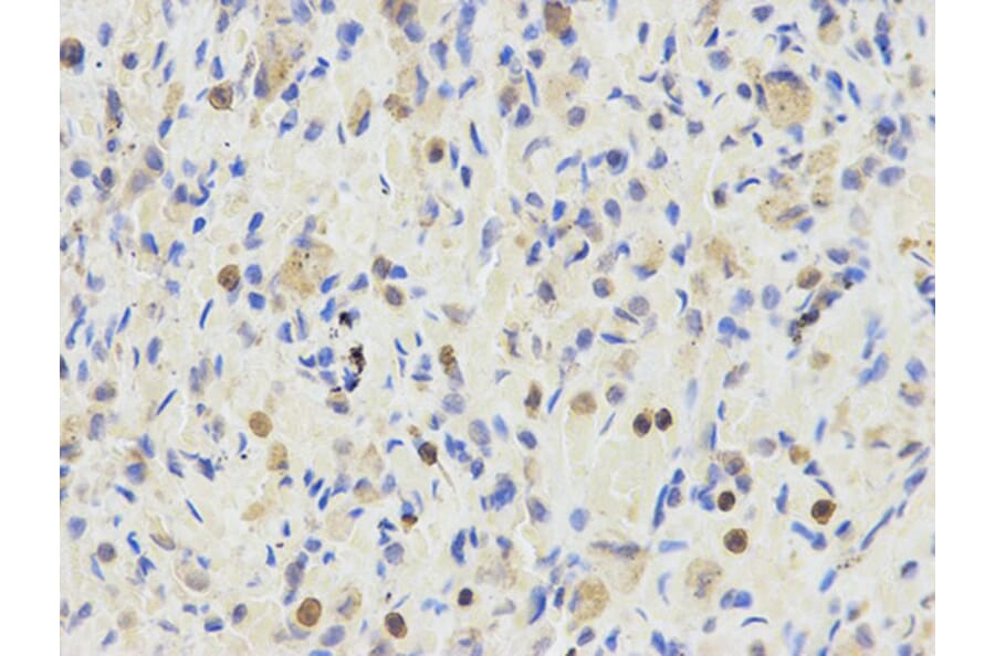 Immunohistochemistry - ETV6 Antibody from Signalway Antibody (32358) - Antibodies.com