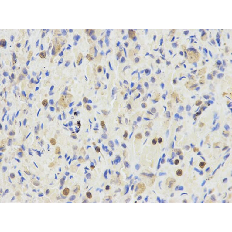 Immunohistochemistry - ETV6 Antibody from Signalway Antibody (32358) - Antibodies.com