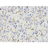 Immunohistochemistry - ETV6 Antibody from Signalway Antibody (32358) - Antibodies.com