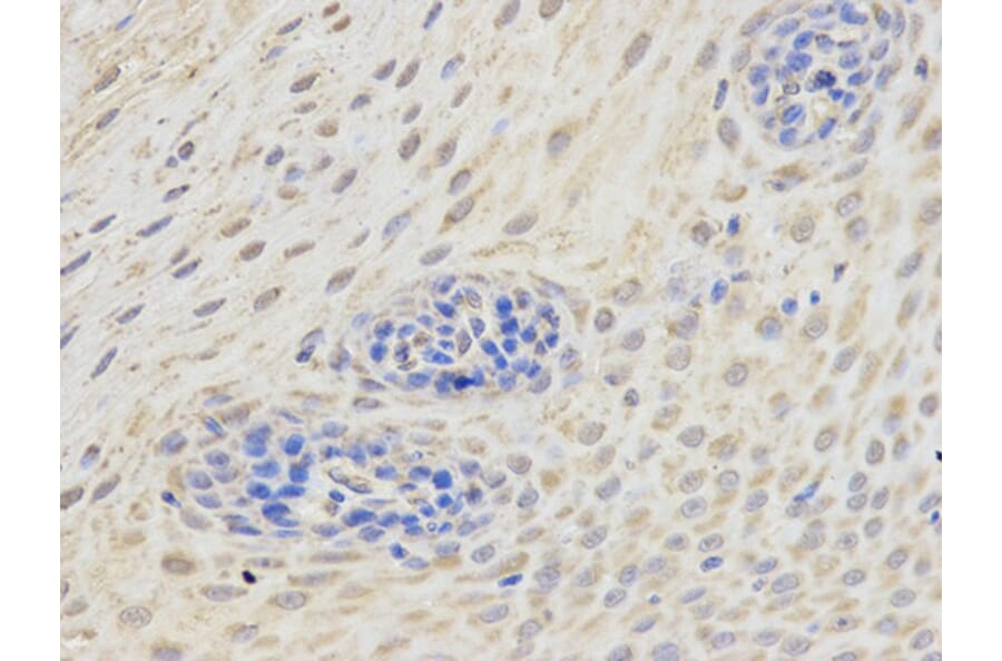 Immunohistochemistry - ETV6 Antibody from Signalway Antibody (32358) - Antibodies.com
