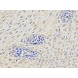 Immunohistochemistry - ETV6 Antibody from Signalway Antibody (32358) - Antibodies.com