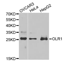 Western blot - OLR1 Antibody from Signalway Antibody (32359) - Antibodies.com