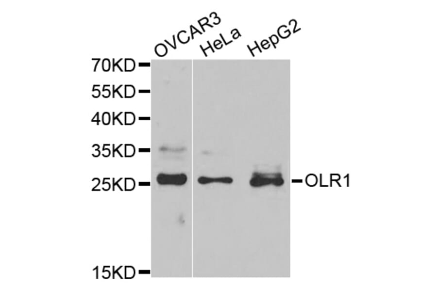 Western blot - OLR1 Antibody from Signalway Antibody (32359) - Antibodies.com