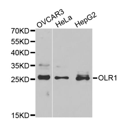 Western blot - OLR1 Antibody from Signalway Antibody (32359) - Antibodies.com