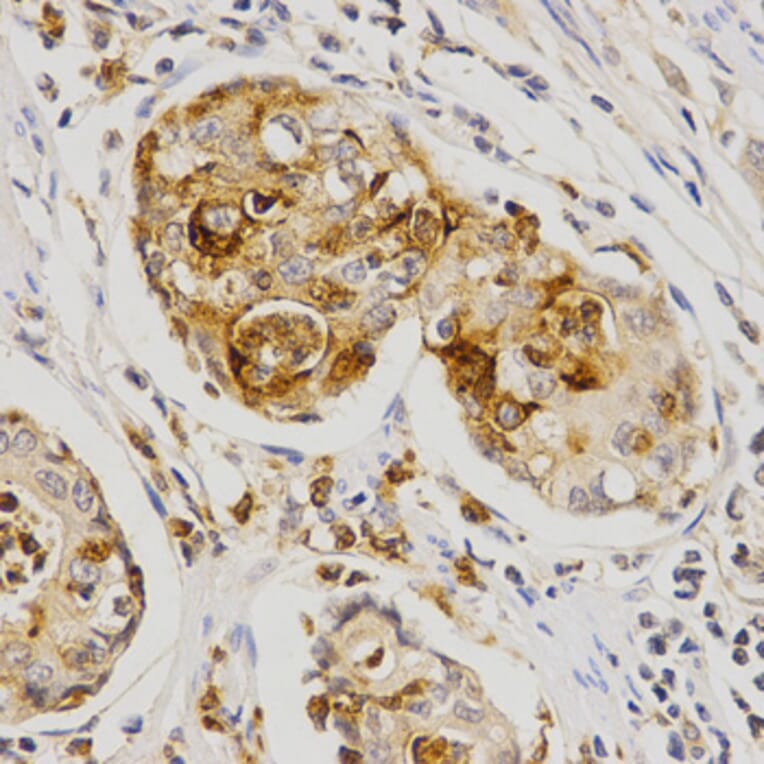 Immunohistochemistry - OLR1 Antibody from Signalway Antibody (32359) - Antibodies.com