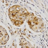Immunohistochemistry - OLR1 Antibody from Signalway Antibody (32359) - Antibodies.com