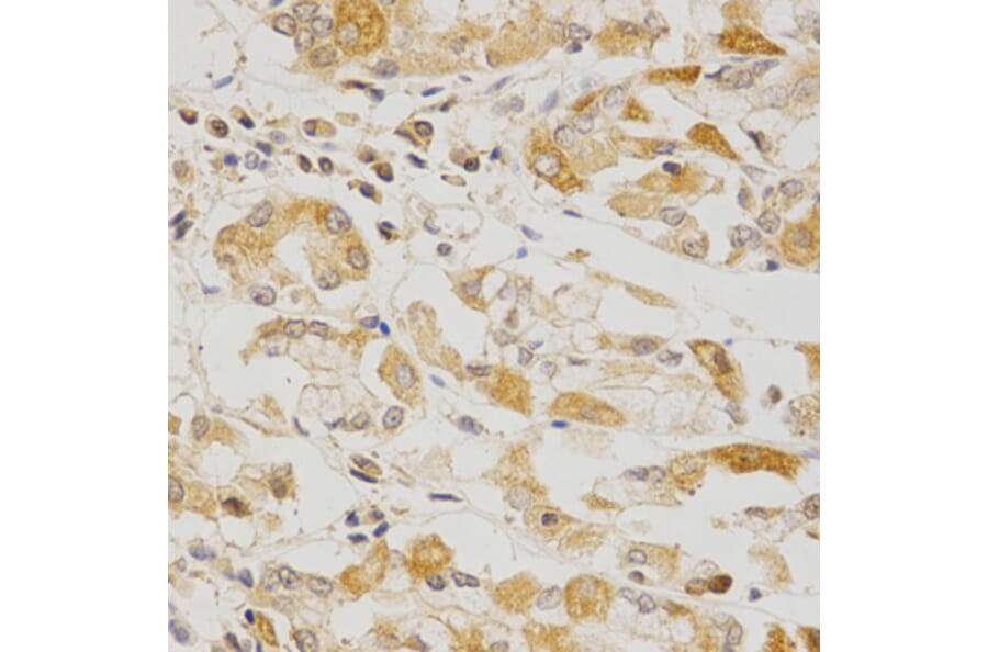 Immunohistochemistry - OLR1 Antibody from Signalway Antibody (32359) - Antibodies.com