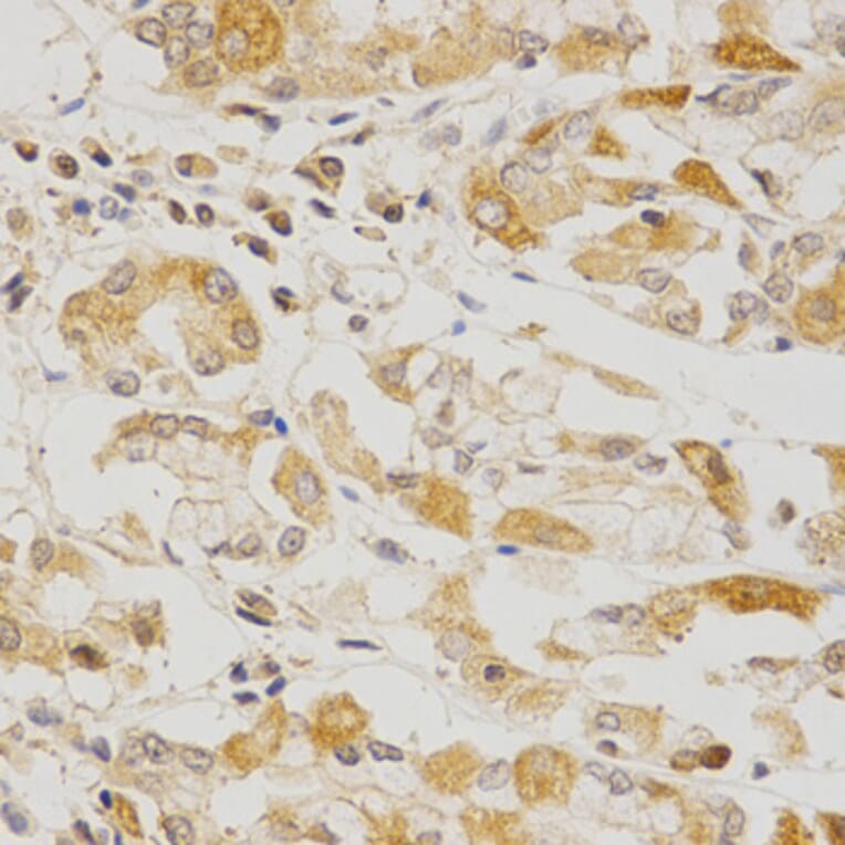 Immunohistochemistry - OLR1 Antibody from Signalway Antibody (32359) - Antibodies.com