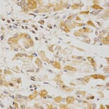 Immunohistochemistry - OLR1 Antibody from Signalway Antibody (32359) - Antibodies.com