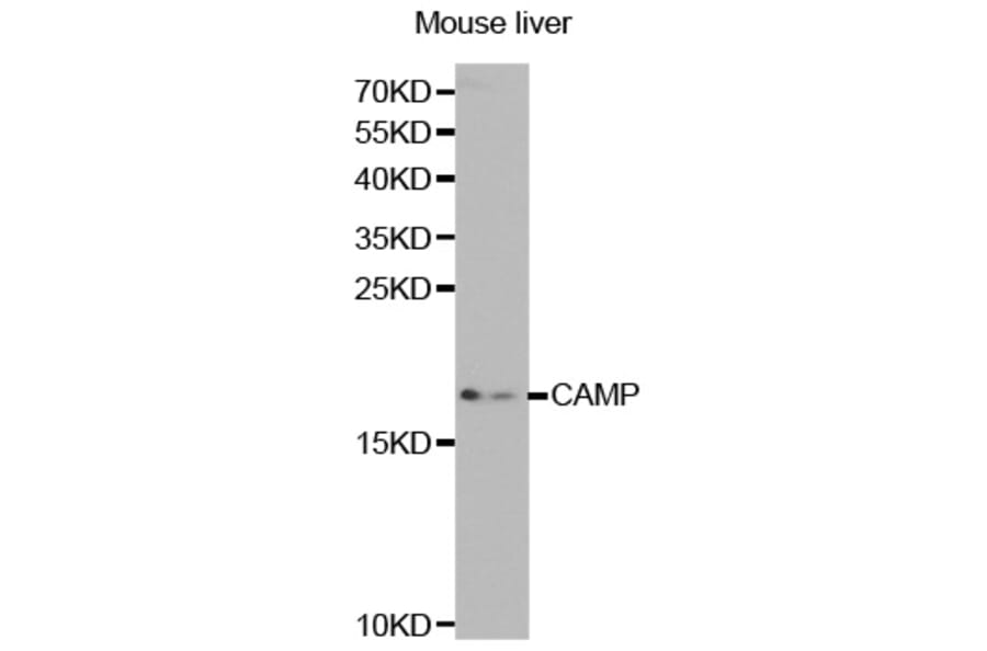 Western blot - CAMP Antibody from Signalway Antibody (32360) - Antibodies.com