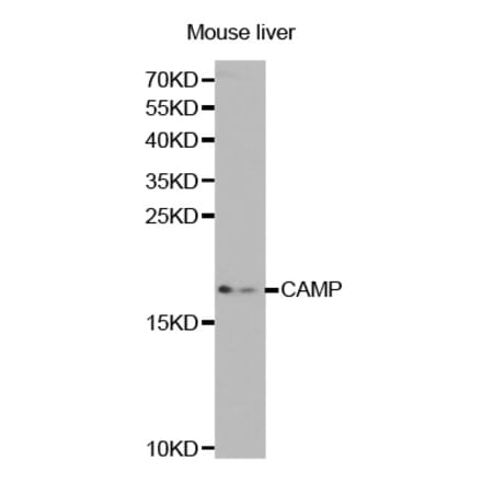 Western blot - CAMP Antibody from Signalway Antibody (32360) - Antibodies.com