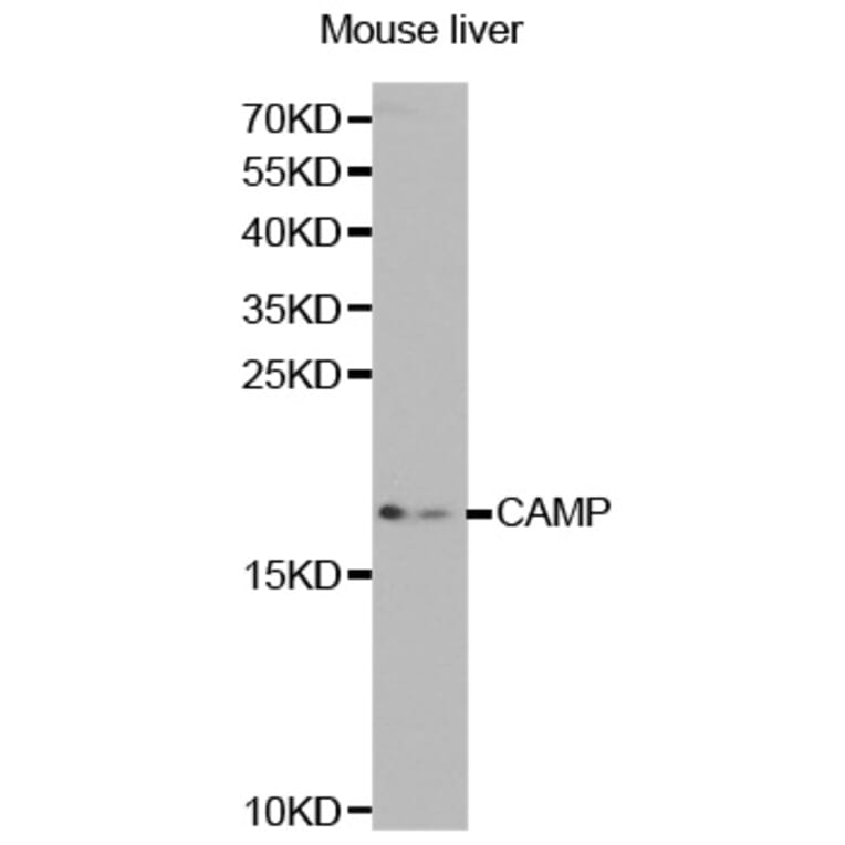 Western blot - CAMP Antibody from Signalway Antibody (32360) - Antibodies.com