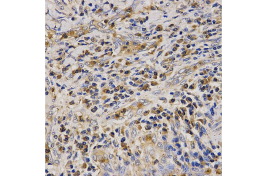 Immunohistochemistry - CAMP Antibody from Signalway Antibody (32360) - Antibodies.com