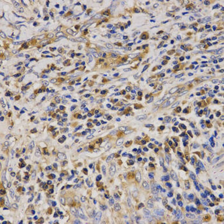 Immunohistochemistry - CAMP Antibody from Signalway Antibody (32360) - Antibodies.com