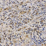 Immunohistochemistry - CAMP Antibody from Signalway Antibody (32360) - Antibodies.com