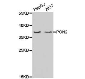 Western blot - PON2 Antibody from Signalway Antibody (32364) - Antibodies.com