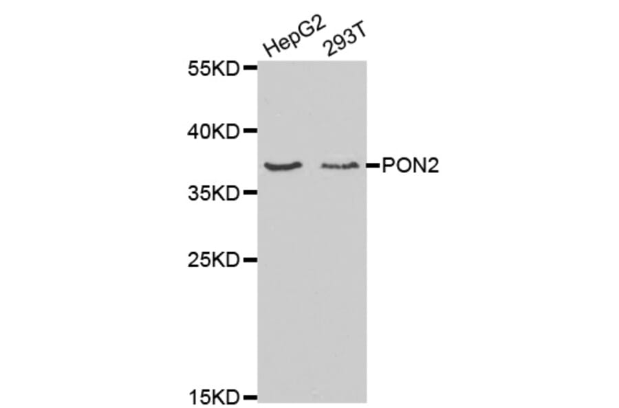 Western blot - PON2 Antibody from Signalway Antibody (32364) - Antibodies.com