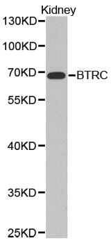 Western blot analysis of extracts of Kidney cell line, using BTRC antibody.