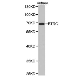 Western blot - BTRC Antibody from Signalway Antibody (32369) - Antibodies.com