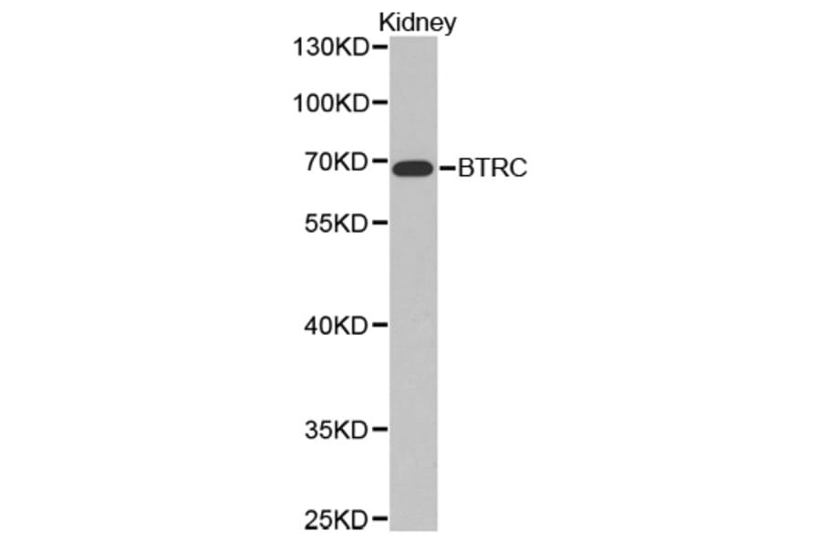 Western blot - BTRC Antibody from Signalway Antibody (32369) - Antibodies.com