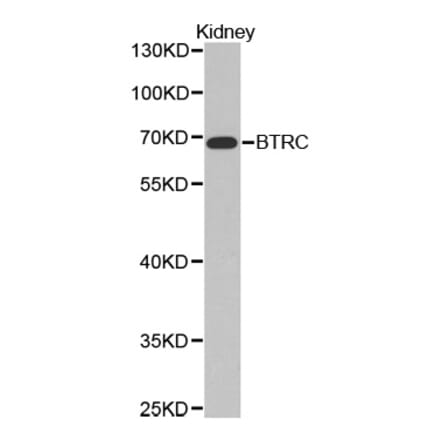 Western blot - BTRC Antibody from Signalway Antibody (32369) - Antibodies.com