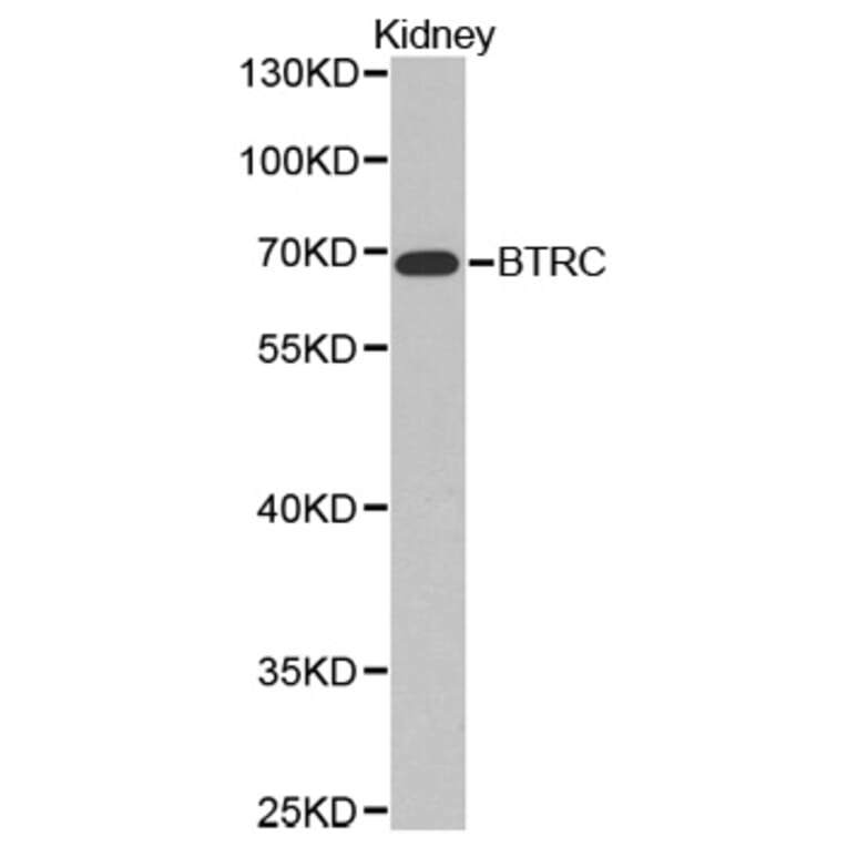 Western blot - BTRC Antibody from Signalway Antibody (32369) - Antibodies.com