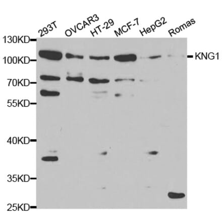 Western blot - KNG1 Antibody from Signalway Antibody (32377) - Antibodies.com