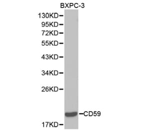 Western blot - CD59 Antibody from Signalway Antibody (32388) - Antibodies.com