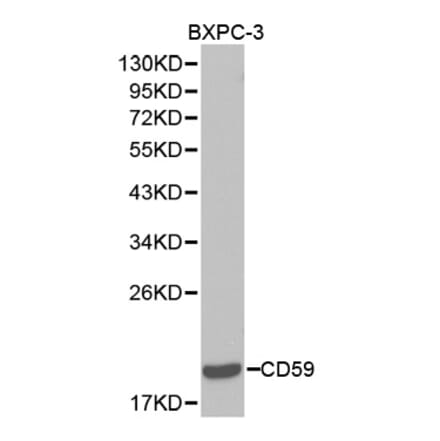 Western blot - CD59 Antibody from Signalway Antibody (32388) - Antibodies.com