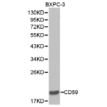 Western blot - CD59 Antibody from Signalway Antibody (32388) - Antibodies.com
