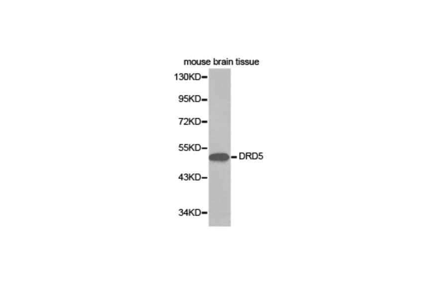Western blot - DRD5 Antibody from Signalway Antibody (32402) - Antibodies.com