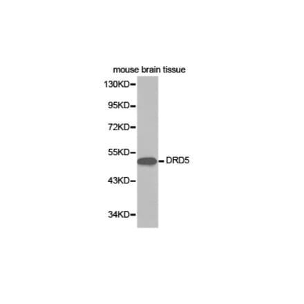 Western blot - DRD5 Antibody from Signalway Antibody (32402) - Antibodies.com