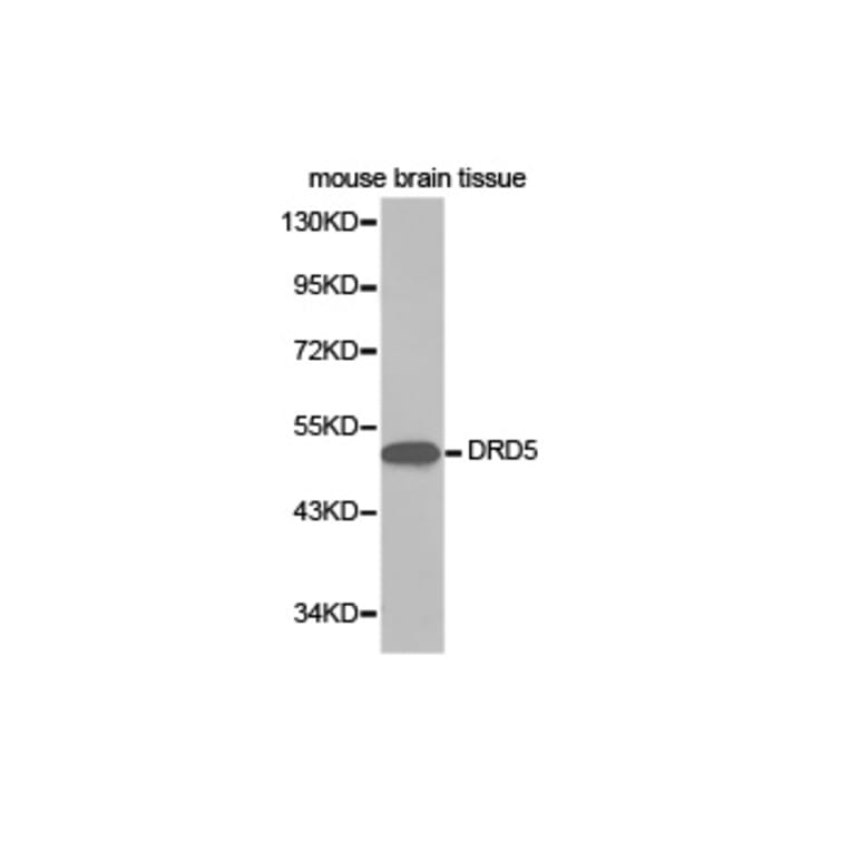 Western blot - DRD5 Antibody from Signalway Antibody (32402) - Antibodies.com