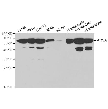 Western blot - ARSA Antibody from Signalway Antibody (32407) - Antibodies.com