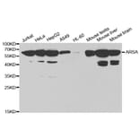 Western blot - ARSA Antibody from Signalway Antibody (32407) - Antibodies.com