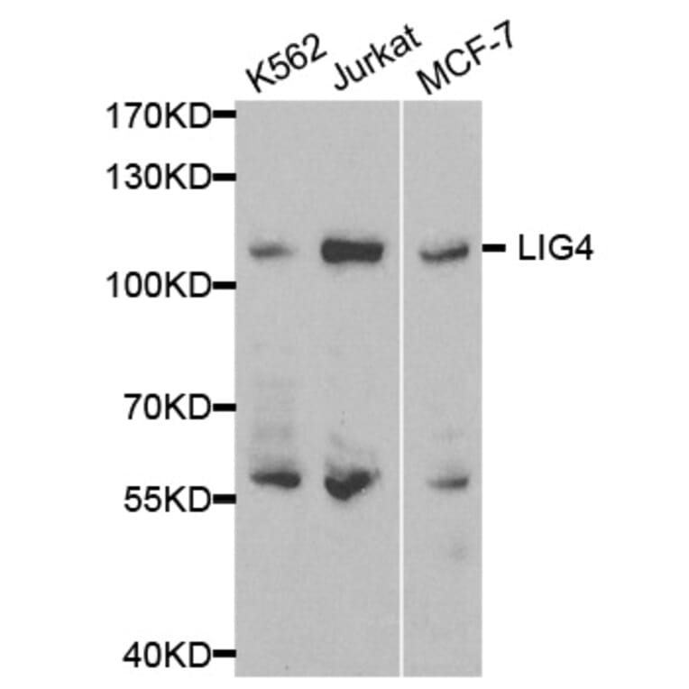 Western blot - LIG4 Antibody from Signalway Antibody (32411) - Antibodies.com