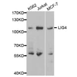 Western blot - LIG4 Antibody from Signalway Antibody (32411) - Antibodies.com