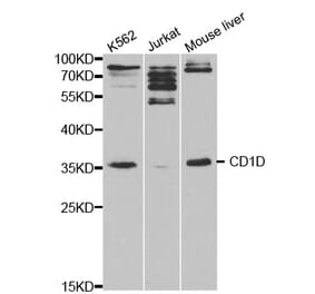 Western blot - CD1D Antibody from Signalway Antibody (32419) - Antibodies.com