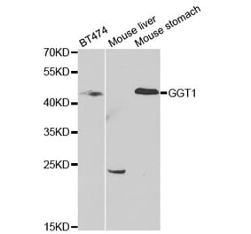 Western blot - GGT1 Antibody from Signalway Antibody (32429) - Antibodies.com