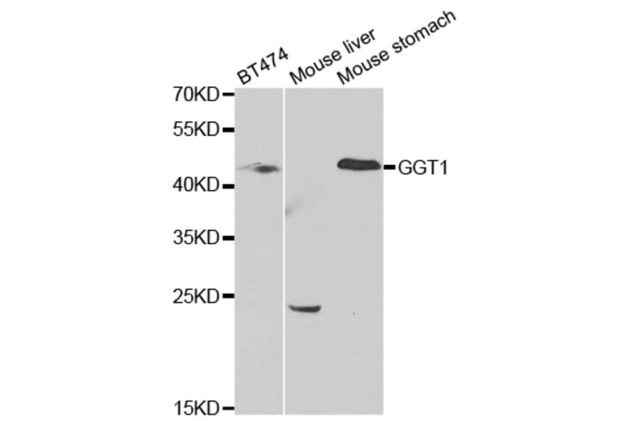 Western blot - GGT1 Antibody from Signalway Antibody (32429) - Antibodies.com